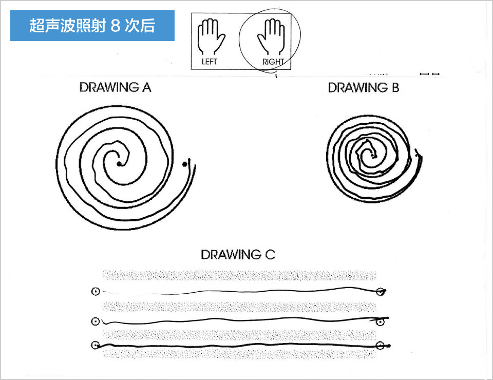 超声波照射8次后