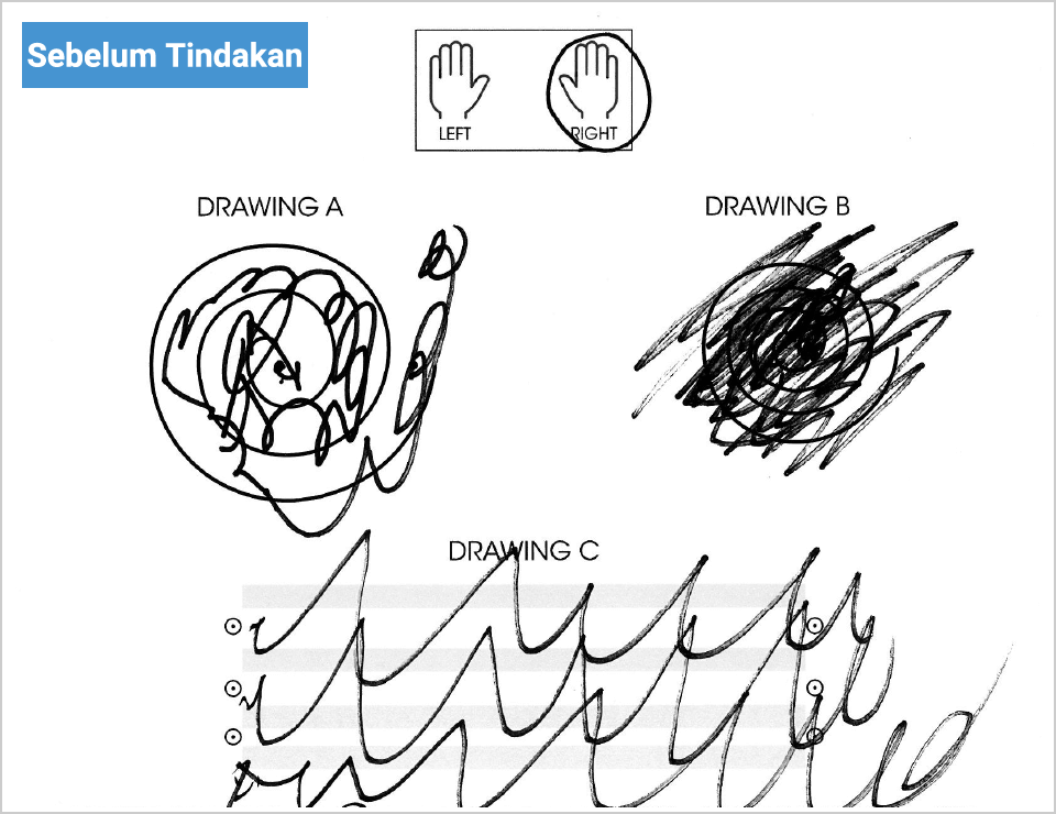 Sebelum Tindakan