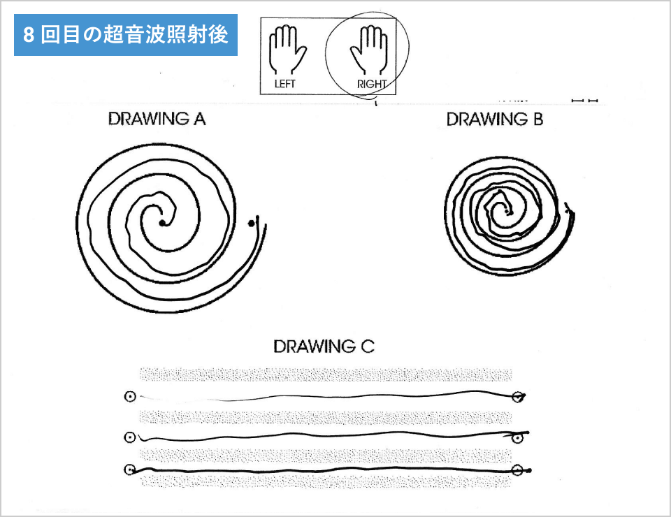 8回目の超音波照射後